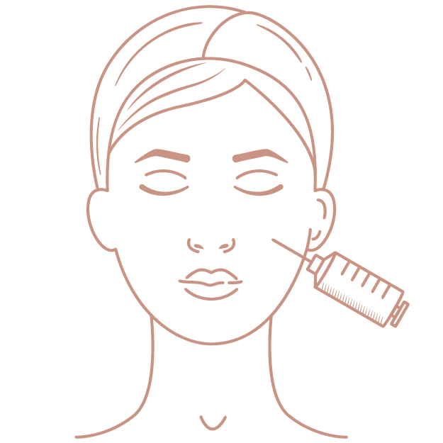 Botulinum toxin A (Botox)